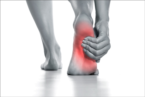 족저근막염 증상 포스터