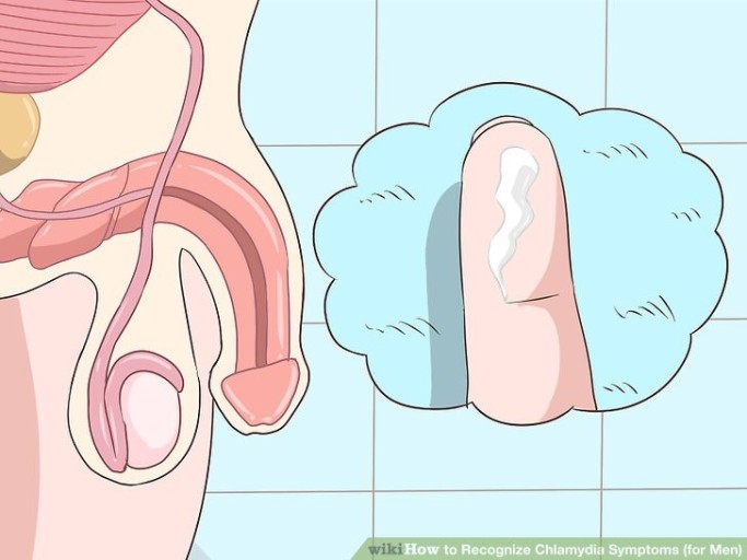 성기 클라미디아 감염증