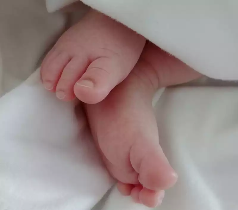 아기의 접힌 살 트러블 케어방법