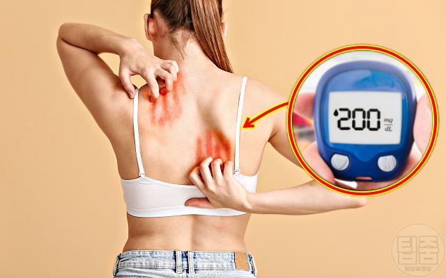 숨은 당뇨병 증상