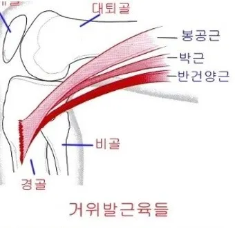 거위발 건염 원인과 증상 무릎 안쪽 통증 치료법 정리_4