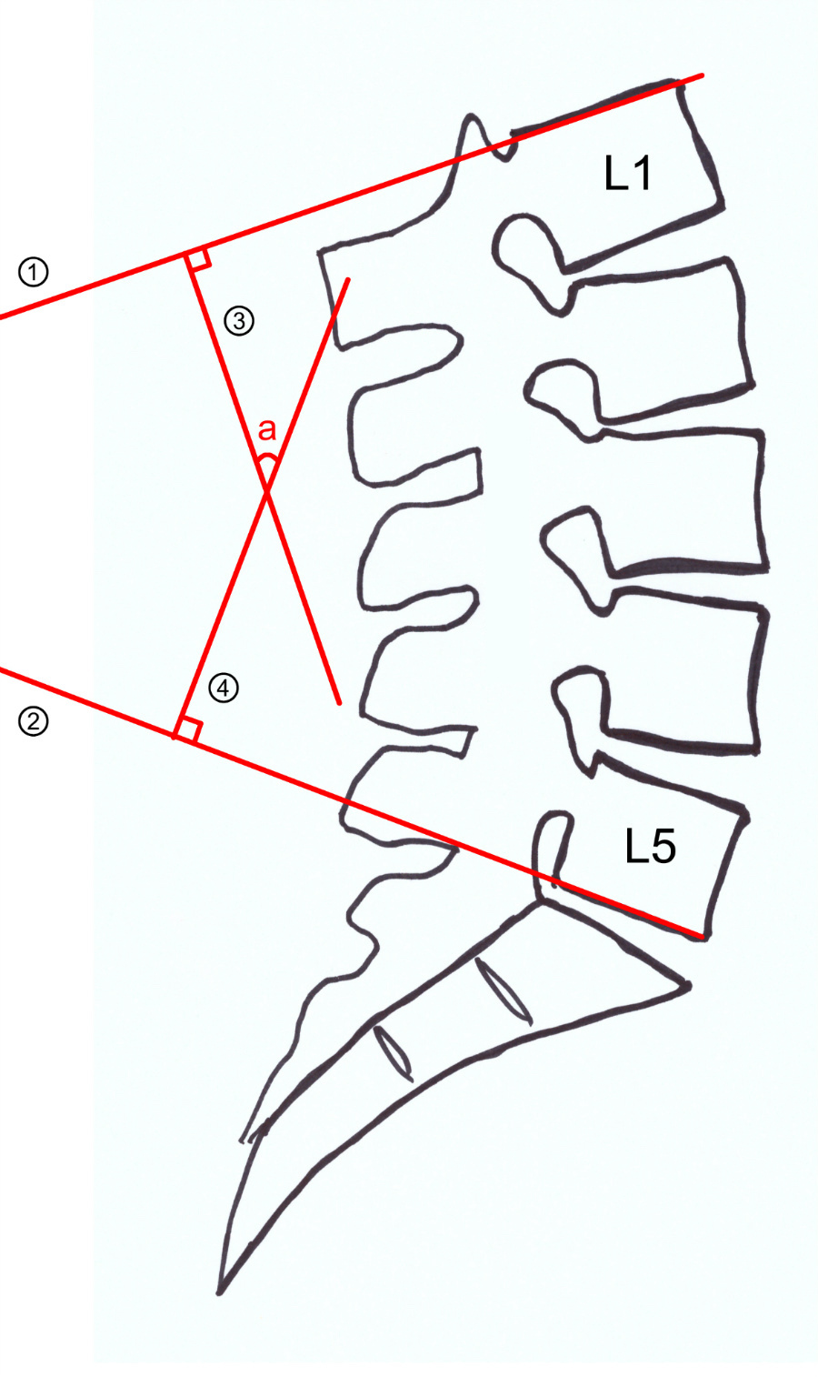 Lumbar lordodsis angle