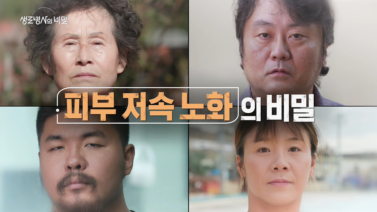 생로병사의 비밀 피부 저속노화의 비밀