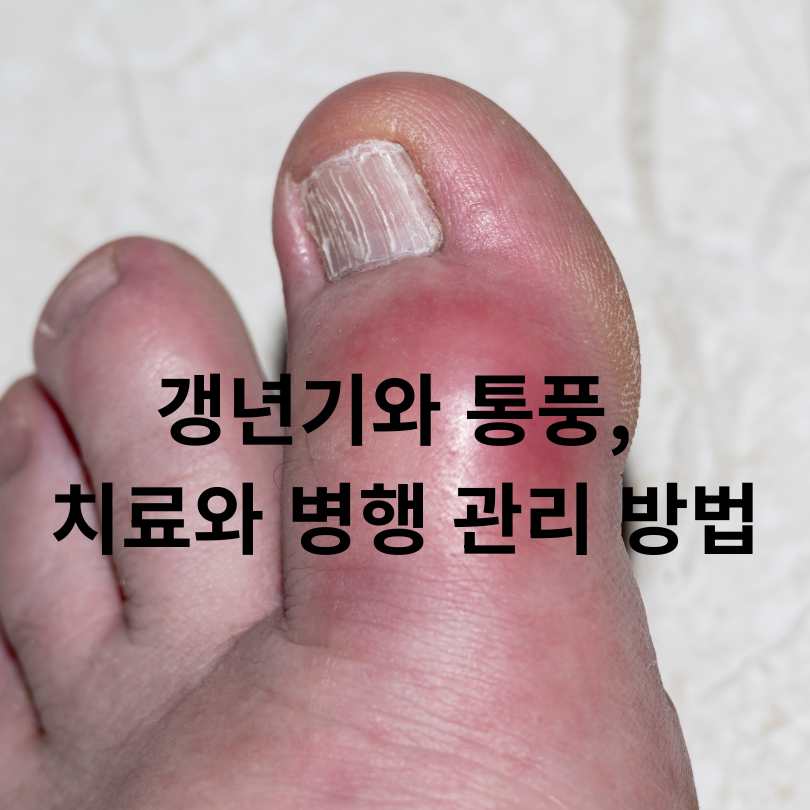 갱년기 통풍 증상과 원인&amp;#44; 예방하는 식습관 꿀팁