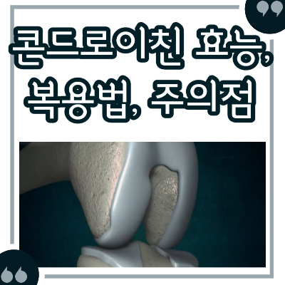 콘드로이친