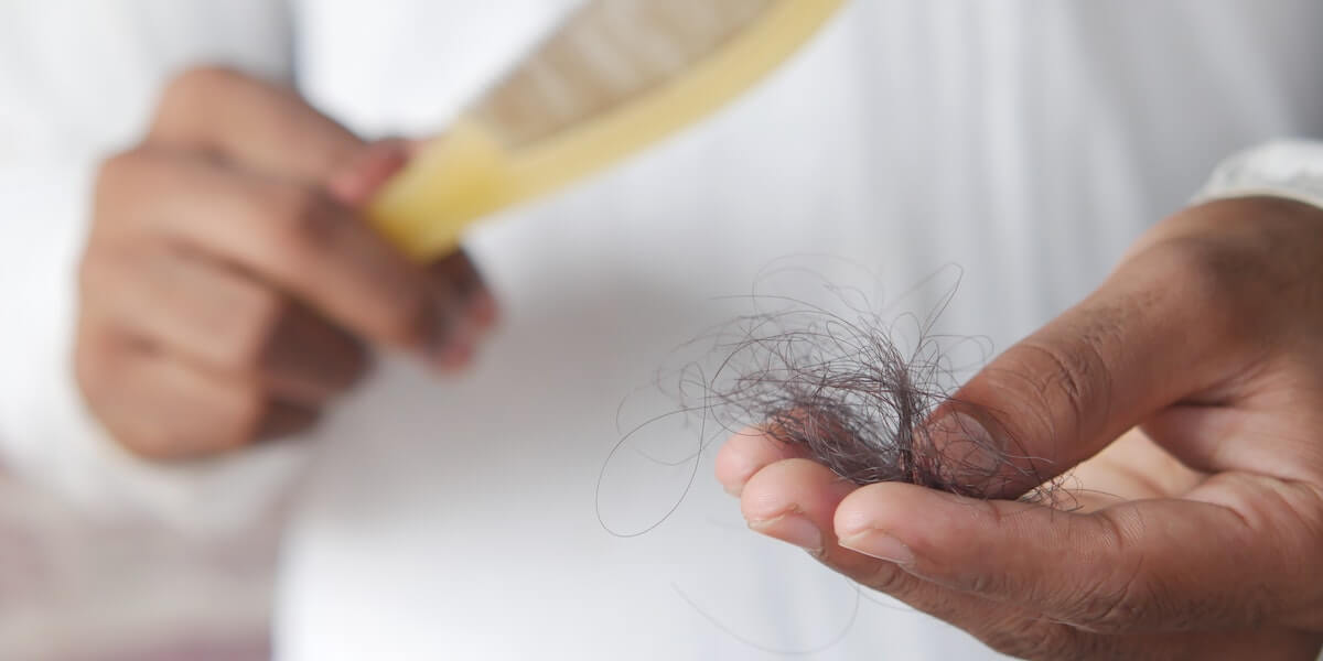 원형탈모의 예방법