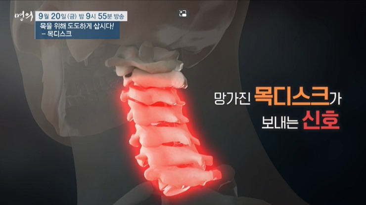 경추