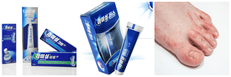 라미실크림, 라미실원스, 무좀 사진