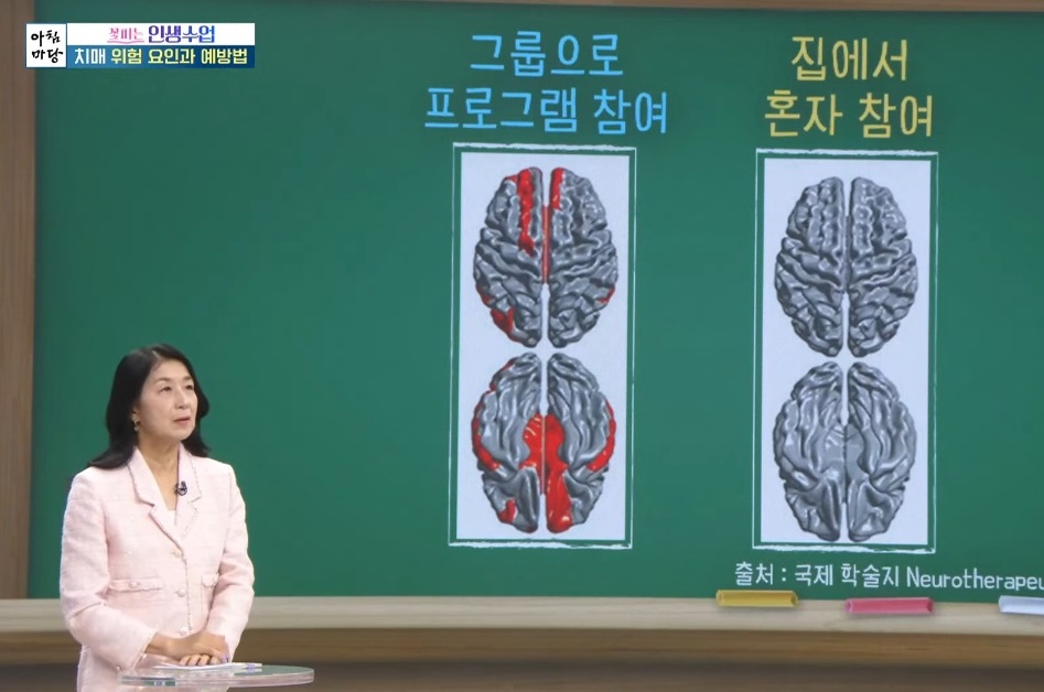 EBS명의-알츠하이머-치매