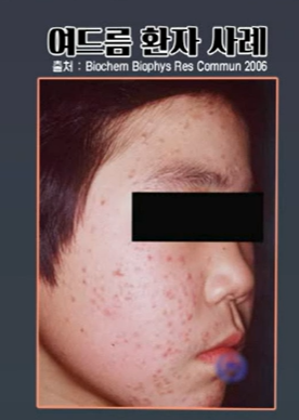 프로테오글리칸 효능