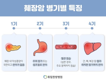 췌장암 초기증상과 진단 지연의 원인 – 왜 침묵의 암인가