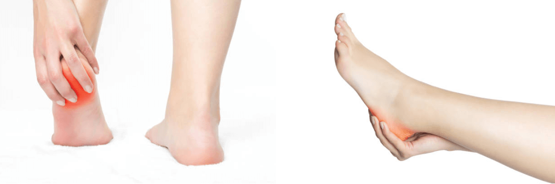 왼쪽 발 뒤꿈치 통증