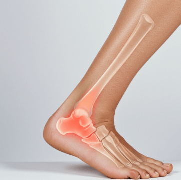 발목 안쪽 통증, 병원 1