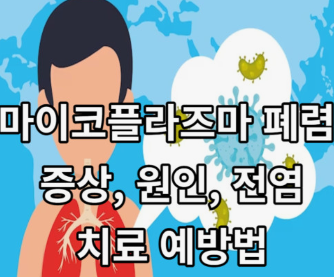 마이코-플라즈마-폐렴-초기증상