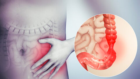 과민성 대장증후군 증상