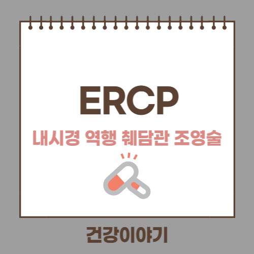 ERCP에 대해