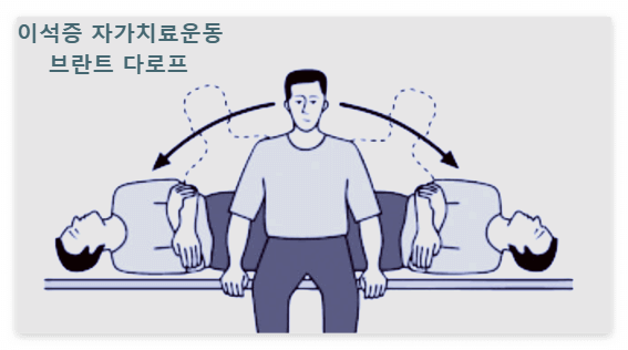 이석증 자가치료운동-브란트 다로프