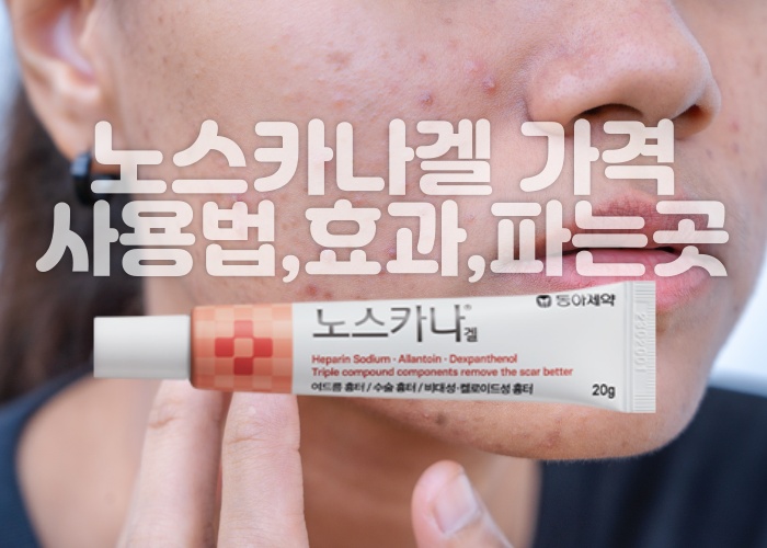 노스카나겔 가격, 사용법, 효과, 파는곳