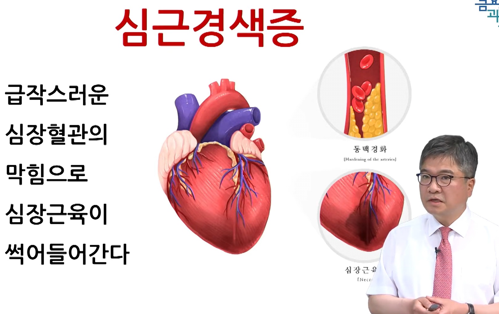 급성-심근경색-안영근-교수