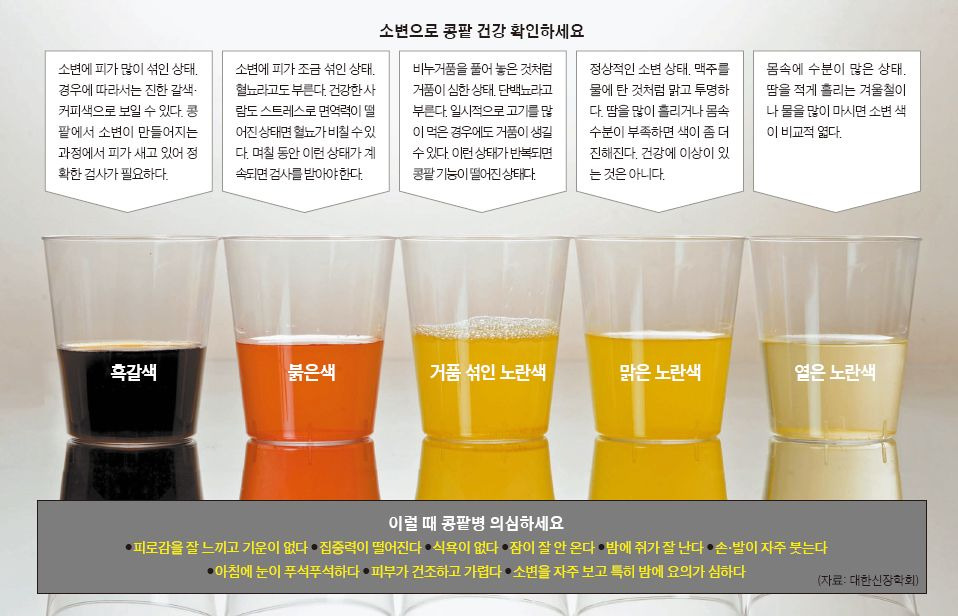 소변으로 콩팥 건강