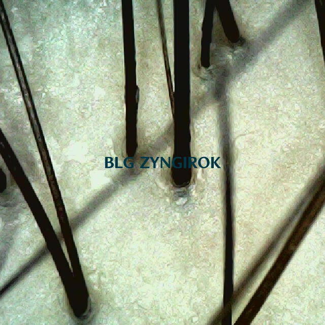 정수리 부분 두피사진이다.