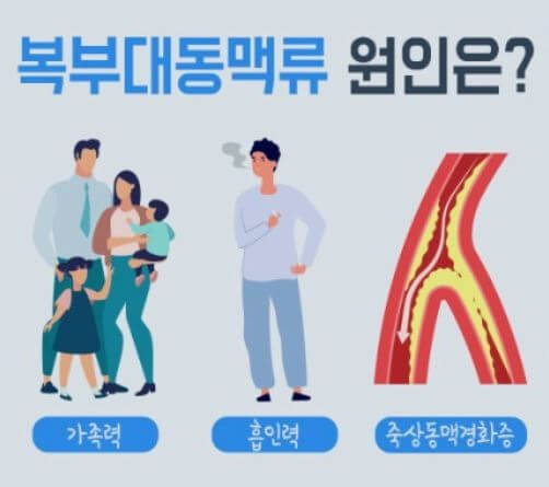 복부 대동맥류 증상과 원인 및 자가진단