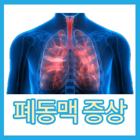 폐똥맥 돌연사 폐동맥고혈압 원인 증상 진단 검사 치료법