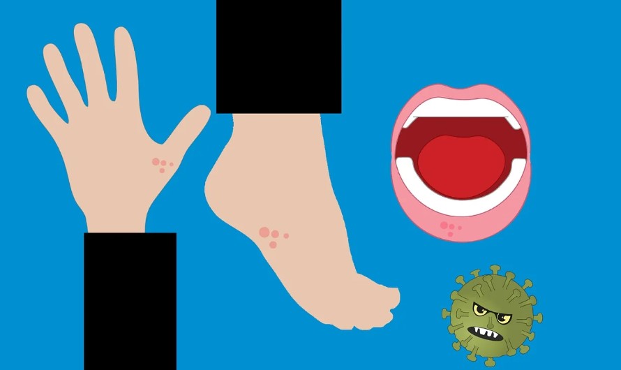 단순포진 헤르페스감염증