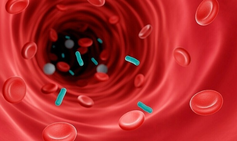 패혈증 원인별 항생제 선택 가이드