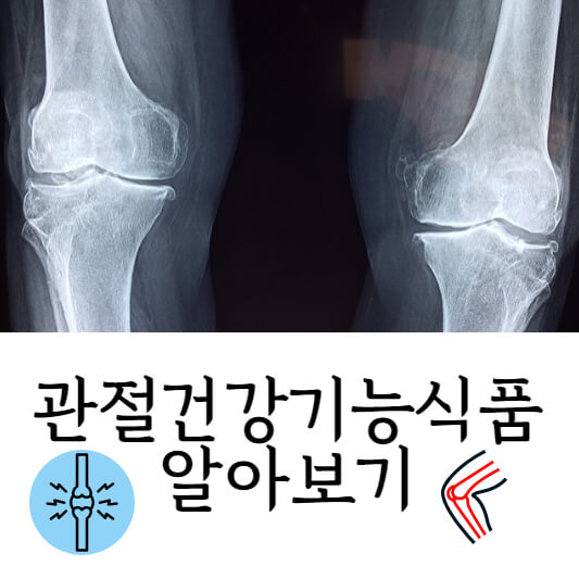 관절건강기능식품