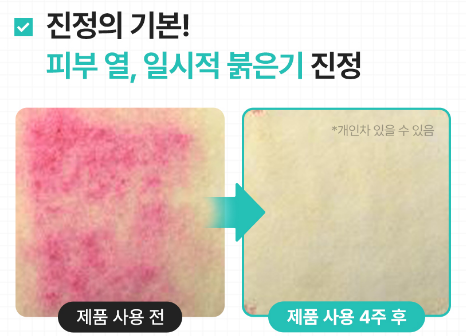 📌 이런 분들! '닥터지 레드 블레미쉬 클리어 크림' 꼭 써보세요