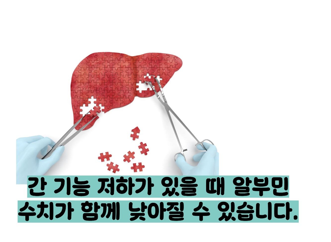 알부민 수치 낮으면