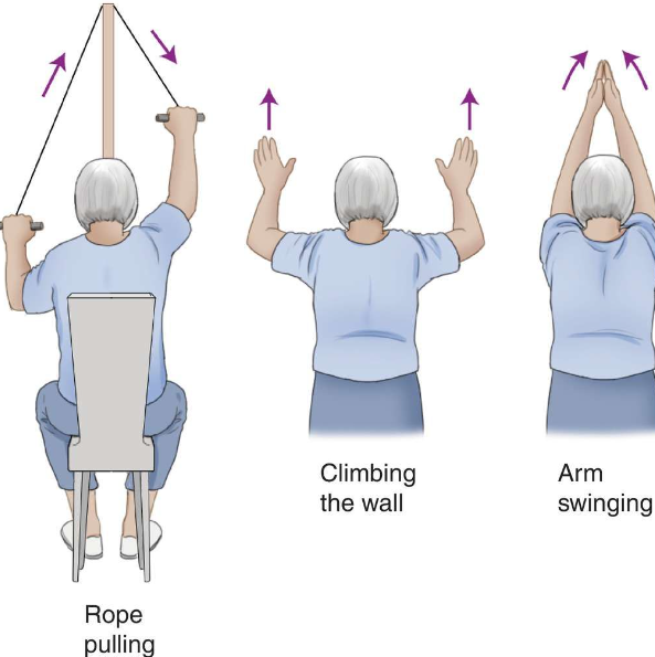 오십견 운동방법