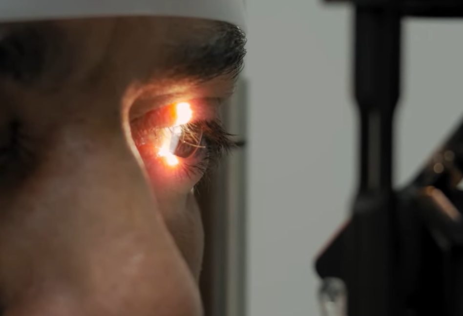 녹내장 초기증상