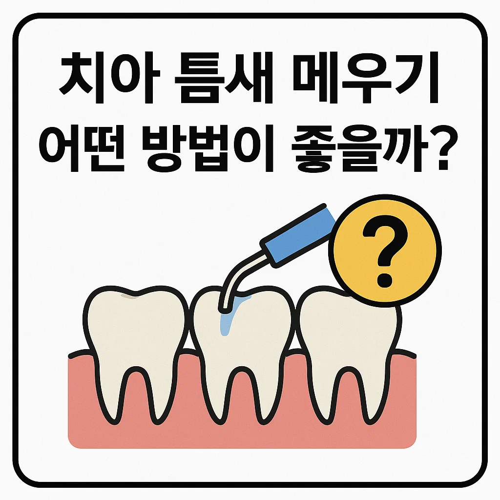 치아 틈새 메우기, 레진과 라미네이트 중 어떤 방법이 좋을까?