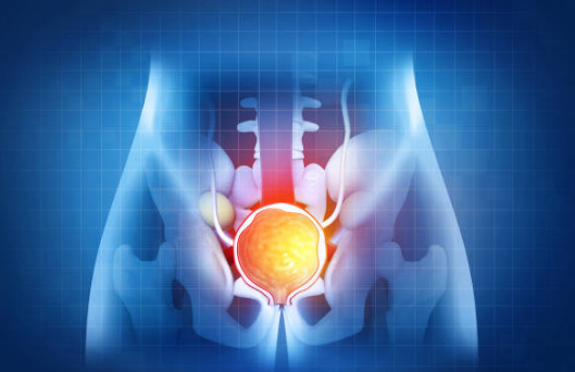 전립선 비대증 원인, 증상, 수술 총정리 (2024ver)