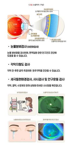 성인 사시 수술