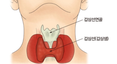 갑상선 이미지