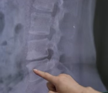 허리