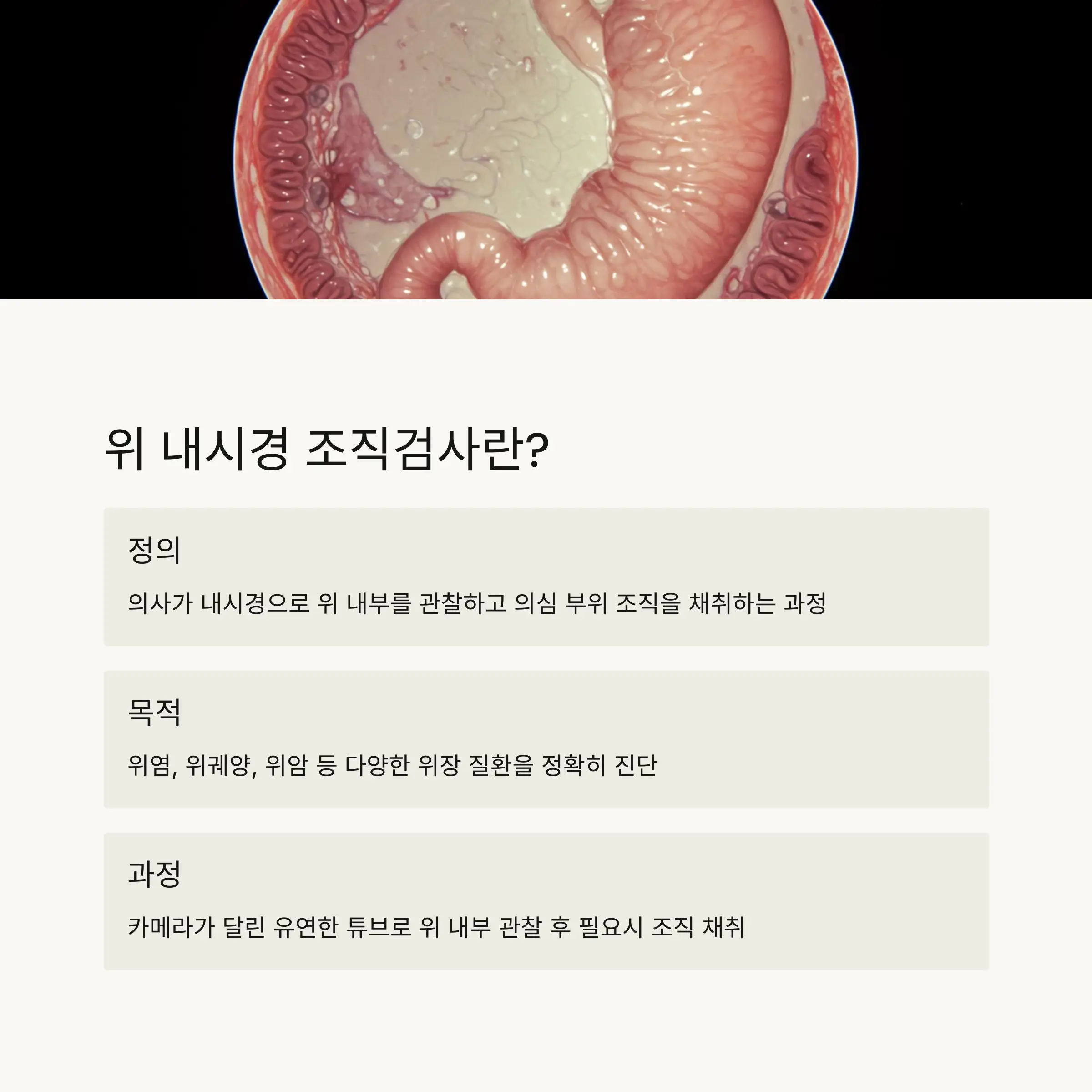 🔍 위 내시경 조직검사란 무엇인가?