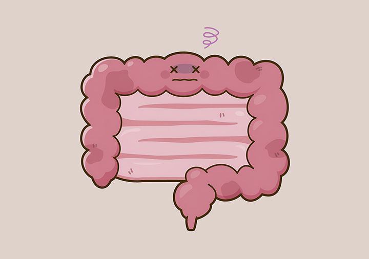 소화-불량이-있는-장의-모습