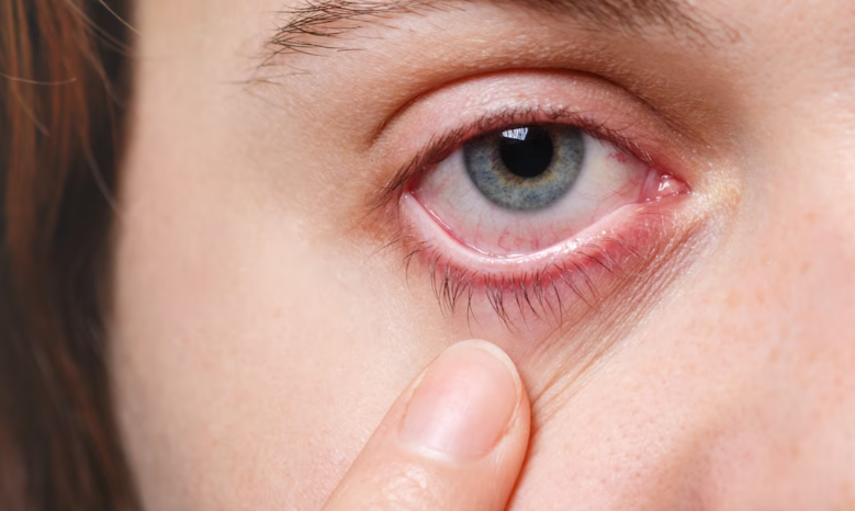 각막 부종의 원인