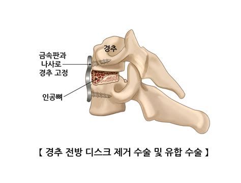 디스크
