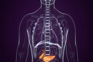 담석-제거-수술