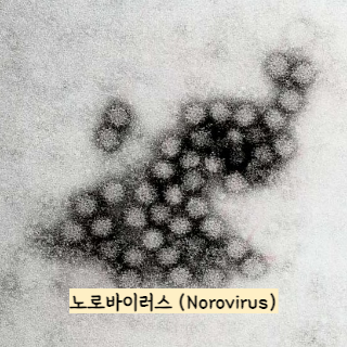 식중독-증상