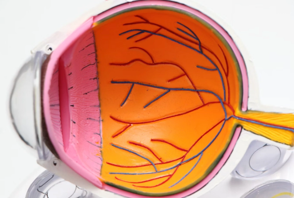 녹내장 초기증상