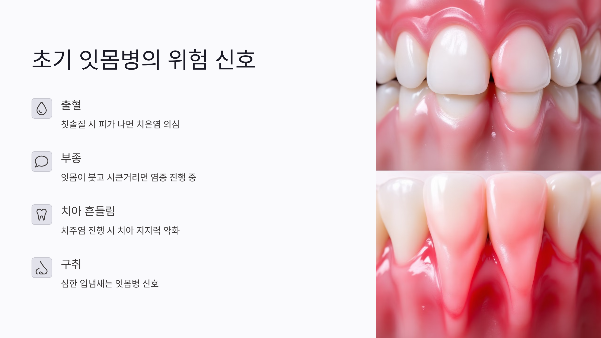 초기 잇몸병, 왜 레이저 치료가 주목받을까?