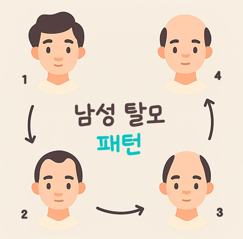 탈모약 탈모 치료제 부작용