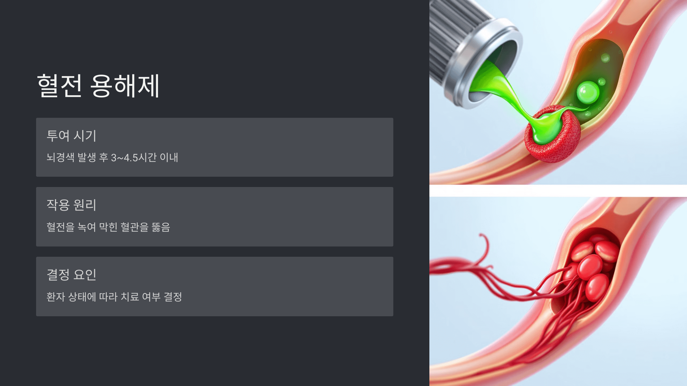 뇌경색과 관련된 사진입니다.