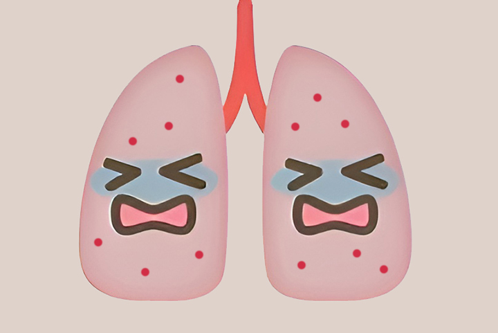 염증이-생긴-폐모습